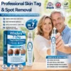 Windyra® 7-𝐷𝑎𝑦 𝗧𝐚𝐠 & 𝗦𝗽𝐨𝐭 𝐄𝐫𝒂𝒔𝒆𝒓(Zero Pain, Zero 𝐒𝐜𝐚𝒓𝒔 Rollerball)