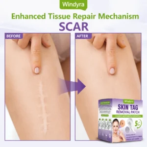Windyra® Soluble Microneedle Botanical Skin Tag Removal Patch